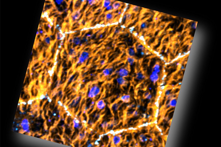 Kuvateksti: Silmänpohjan epiteelisolukkoa. Kuvassa keskellä on epiteelisolu, jonka pinnan nukkalisäkkeet (kullanvärinen), natrium-ionikanavat (valkoinen) ja verkkokalvon aistinsolujen osat (sininen) on leimattu fluoresoiviksi ja kuvattu korkean resoluution konfokaalimikroskoopilla. Kuvan koko 38 x 38 mikrometriä eli millimetrin tuhannesosaa. Kuva: Julia Johansson ja Teemu Ihalainen/Tampereen yliopisto.