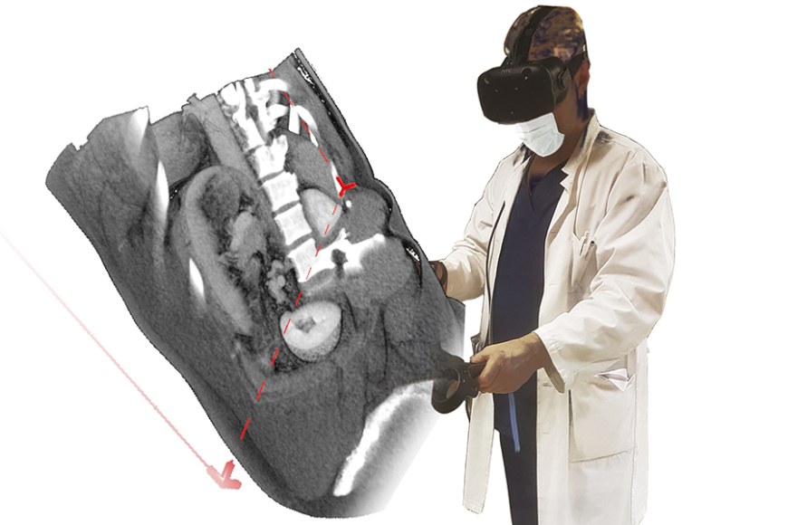 Kuvantamisdatan tuominen virtuaalitodellisuuteen antaa lääkärille mahdollisuuden sukeltaa ihmisen sisään. Kuva: SurgeryVision TM