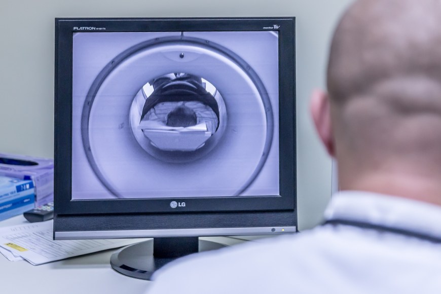 Doctor looking at a MRI scan