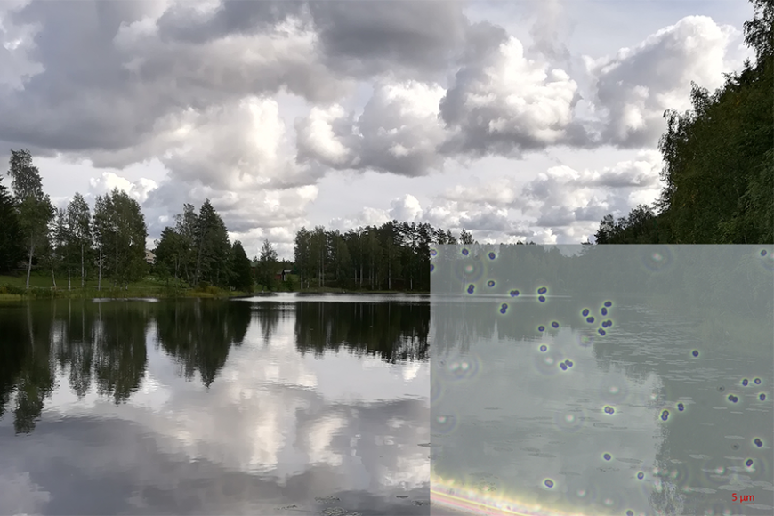 Yhdistelmäkuva, jossa Lovojärvi Hämeenlinnan Lammilla sekä järvestä eristetyn bakteerin valomikroskooppikuva.