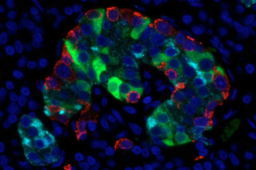 Microscope image of pancreatic islet cells showing red, green and blue.