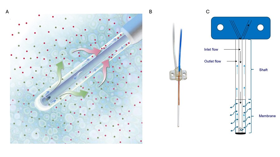 A diagram showing how microdialysis works. The probe is surrounded by a membrane that allows particles of a certain size to pass through. The diagram shows the flow of the solution and the molecules being secreted through the membrane.