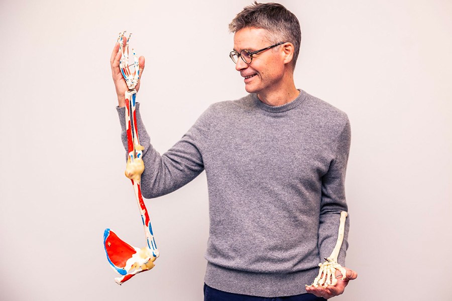 Jarkko Jokihaara is holding prosthetic skeleton hands.