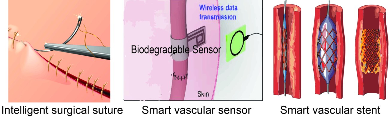 Smart Biomedical PlaTforms Using Advanced Stimuli-Responsive Materials