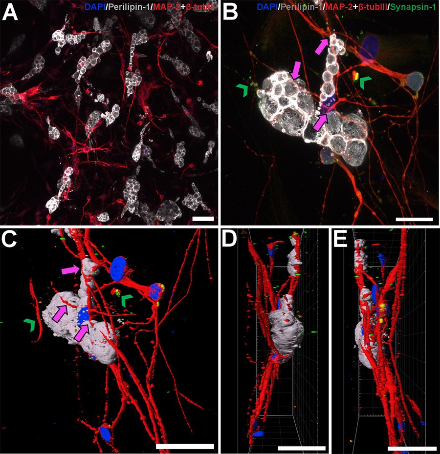 Successful innervation of maturing adipose stem cells in a 3D multicellular model.