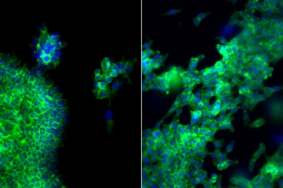 Fluorescence microscopy image showing green and blue cells against a black background.